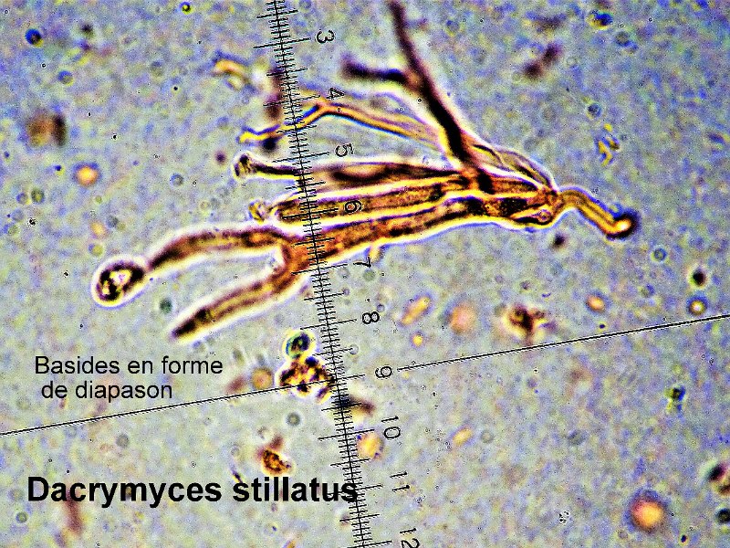Dacrymyces stillatus-amf749-micro.jpg - Dacrymyces stillatus ; Syn1: Tremella deliquescens ; Syn2: Dacrymyces abietinus ; Nom français: Trémelle déliquescente 